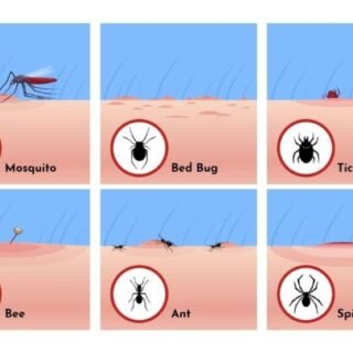 Jenis Gigitan Serangga dan Gambarnya - Photo by Google