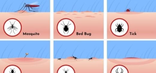 Jenis Gigitan Serangga dan Gambarnya - Photo by Google