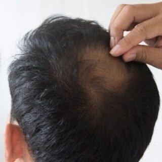 6 Obat Tradisional Penumbuh Rambut Yang Aman - Photo by Google