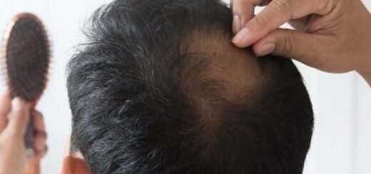 6 Obat Tradisional Penumbuh Rambut Yang Aman - Photo by Google