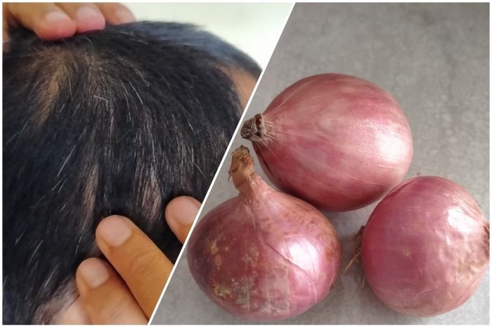 Bawang Merah Untuk Mengatasi Rambut Rontok dan Uban - Photo by Google